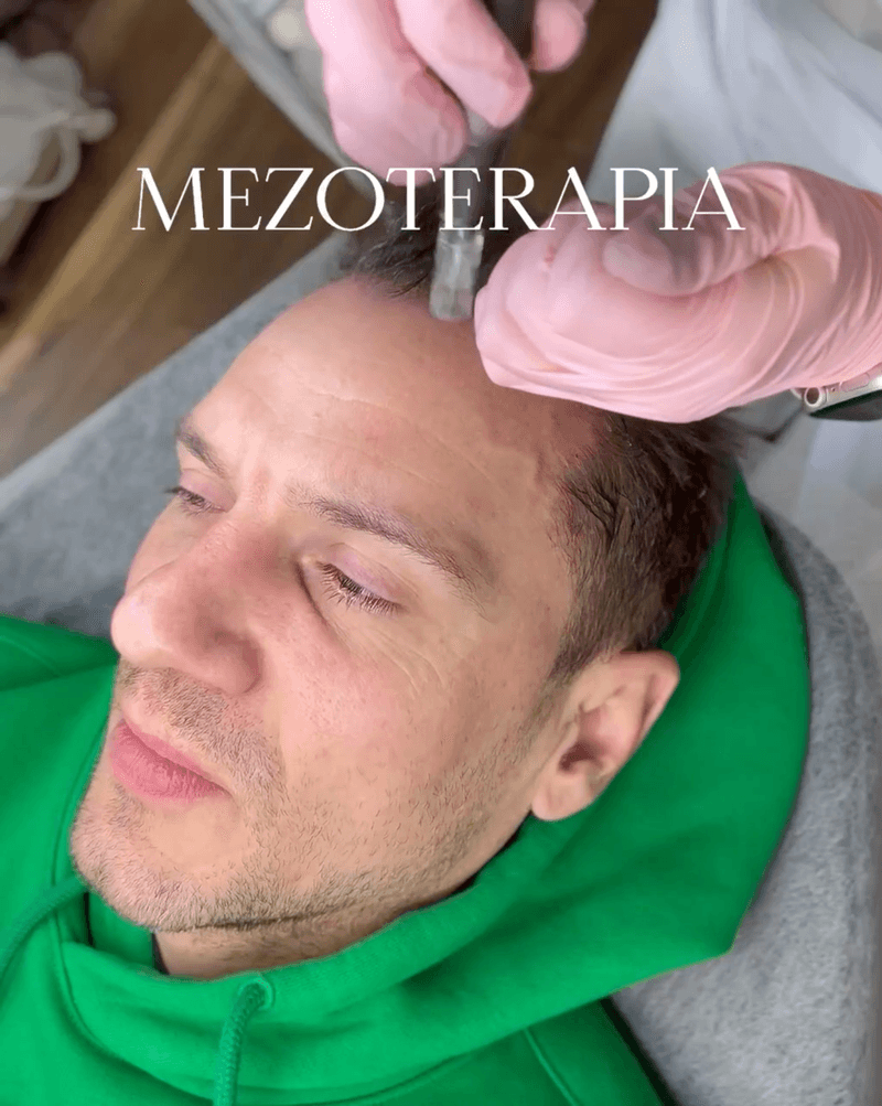 Mezoterapia1IMAGE_.png