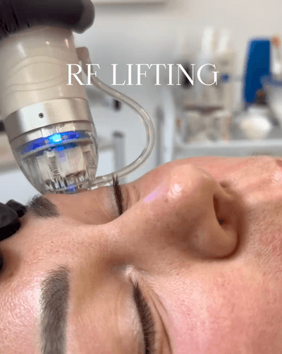 RF_LIFTING1IMAGE_.png
